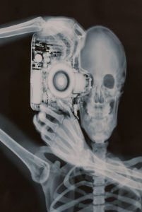 Lire la suite à propos de l’article 4- Les anomalies du squelette