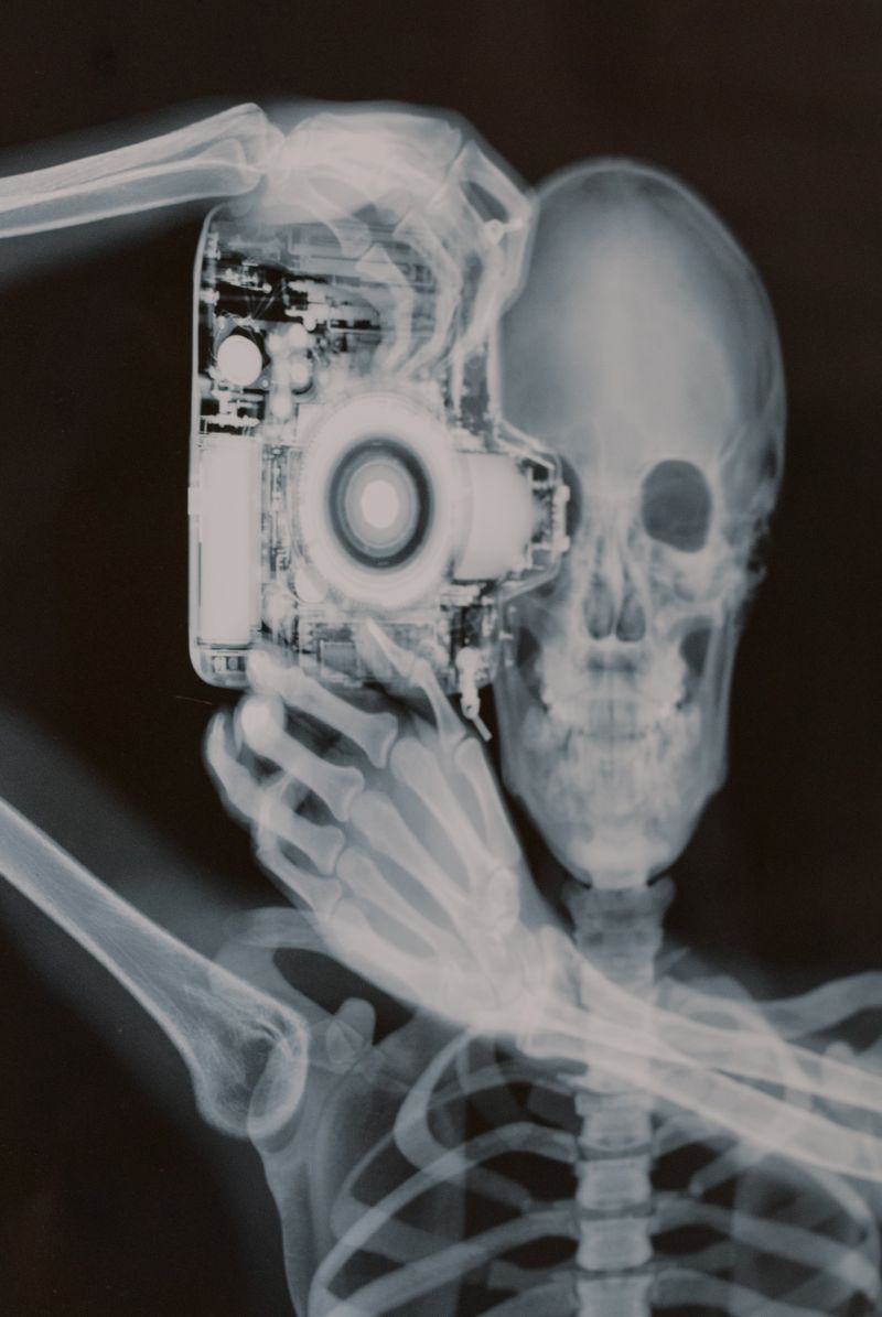 Lire la suite à propos de l’article 4- Les anomalies du squelette