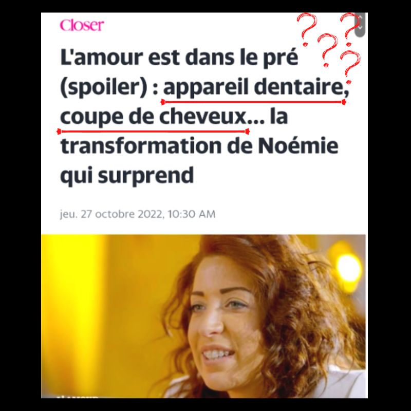 Lire la suite à propos de l’article 7- Un traitement orthodontique laisse des traces