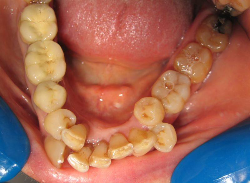 Lire la suite à propos de l’article 30- Encombrement et vieillesse