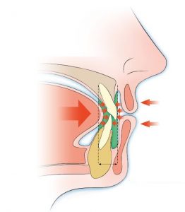 Lire la suite à propos de l’article 34-Les fondamentaux: Le couloir dentaire