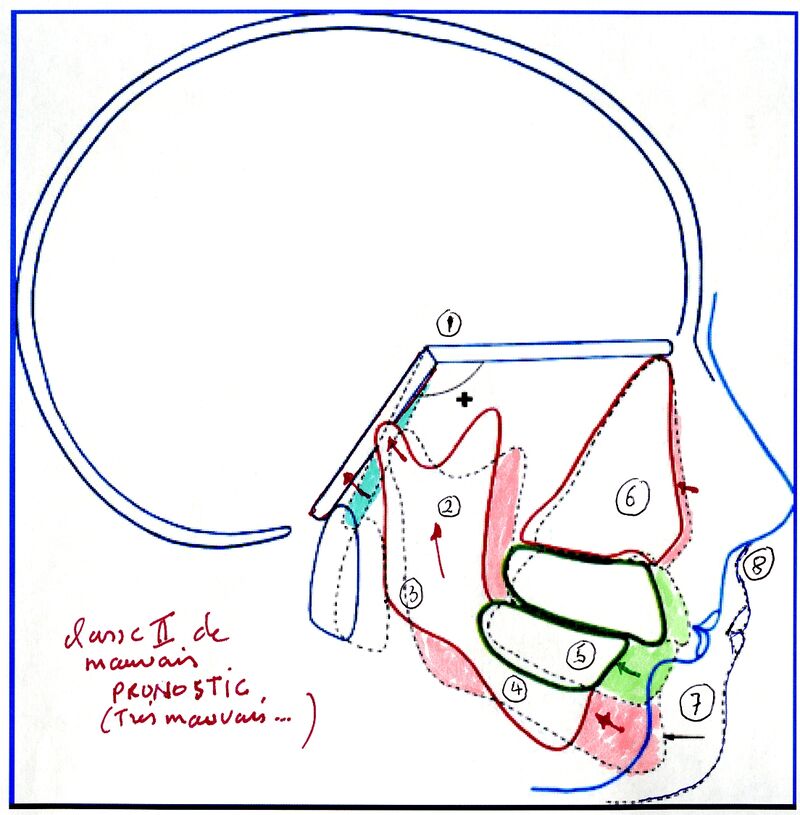 You are currently viewing 41-Doit-on systématiquement traiter très tôt? (3)