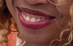 Lire la suite à propos de l’article 49-Quels sont les secrets de ce beau sourire!!!